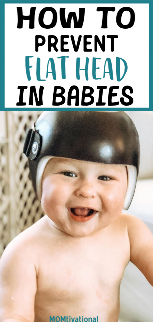 How To Prevent Flat Head in Babies? Do you know if your newborn has flathead? What is flat head?!? Being a new mom can be stressful, but these little tips and tricks will help you greatly! Learn how to prevent or reverse flat head syndrome with these tips! Help prevent flat head without a helmet! #flathead #babies #newborn #newmomtips #newmom