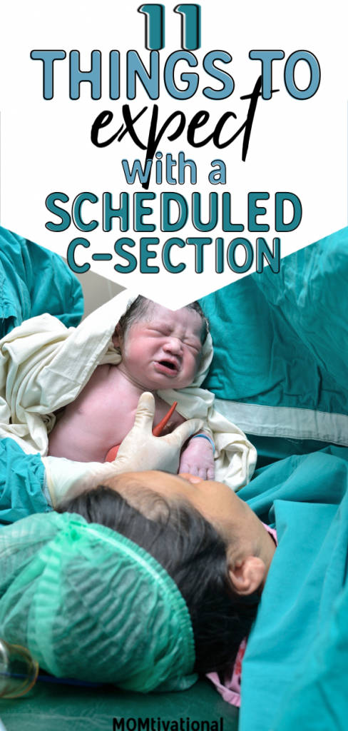 11 Things To Expect With A Scheduled C-Section - MOMtivational