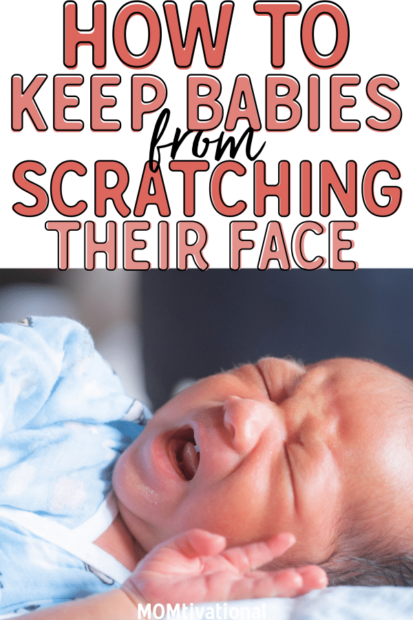 Wondering why does my baby scratch his face so much?! Figure out how to protect baby from scratching face when upset. Although common, you can prevent a baby from scratching their face easily. Also find out when do babies stop scratching their face #Baby #Newborn #NewMomTips