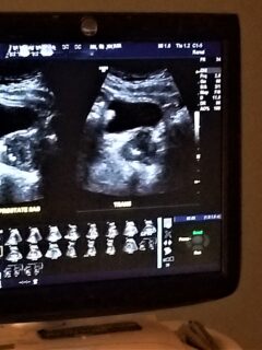 ultrasound on screen